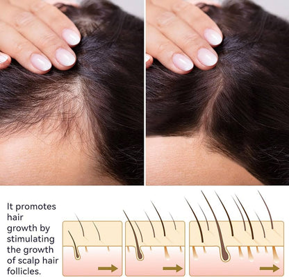 Moisturizing Growth Spray for Damaged Hair